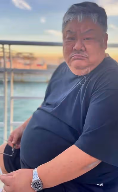 59歲林雪嚴重肥胖引擔憂，臉有黑斑肚大到像懷雙胞胎！本人親回應