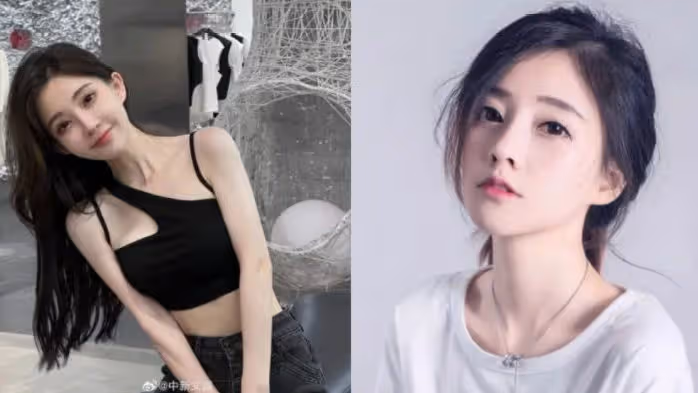 馮提莫患癌曾被告知無法唱歌，康復後開唱，網友：不一樣了