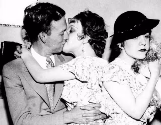 回顧希爾頓姐妹,貌美卻臀部相連,姐姐死後,妹妹與遺體共存2天