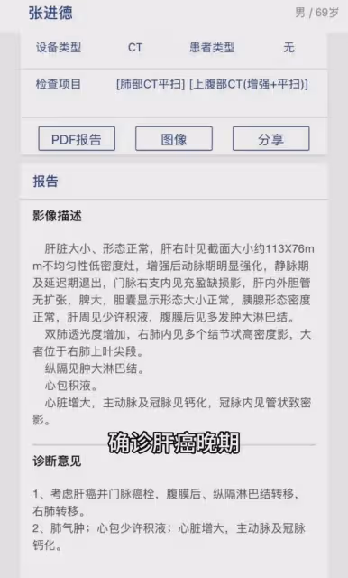 突傳噩耗!網紅張焱父親離世,確診肝癌僅5個月,4天前還在錄段子