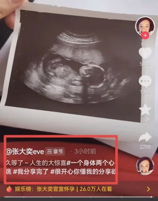 恭喜!網紅張大奕官宣懷孕,初期還熬夜喝酒,否認和蔣凡生子傳聞