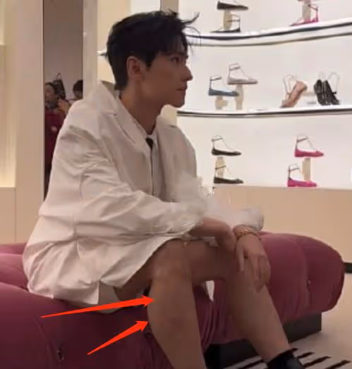 楊洋穿西服短褲現身活動，生圖下身材五五分，被指撞臉炎亞綸