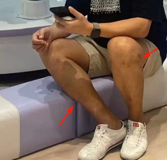 51歲王學兵帶娃被偶遇，滿腿是傷滄桑太多，穿500元鞋子拿倆手機