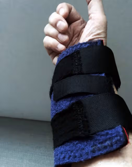 72歲譚詠麟暴瘦14斤，疑又被粉絲扯手加重傷勢須打石膏