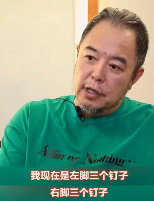 66歲張鐵林健康引擔憂!做手術釘6根釘子,咬牙登台表演臉色蒼白