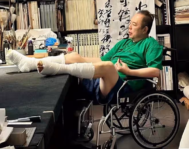 66歲張鐵林健康引擔憂!做手術釘6根釘子,咬牙登台表演臉色蒼白