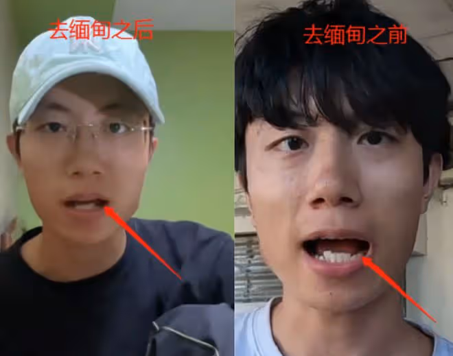 露餡了!網紅胡懿懿疑緬甸被控制,報平安視頻摳圖明顯,大牙缺失