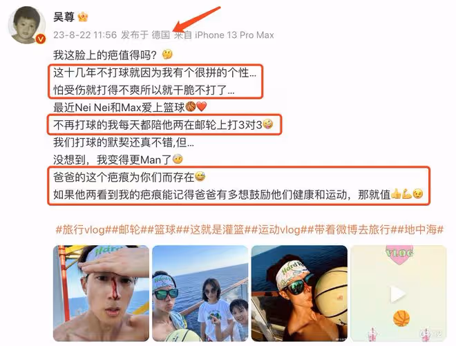吳尊打籃球鼻樑受傷流血,先淡定拍照留念,在線求助自曝傷口很深