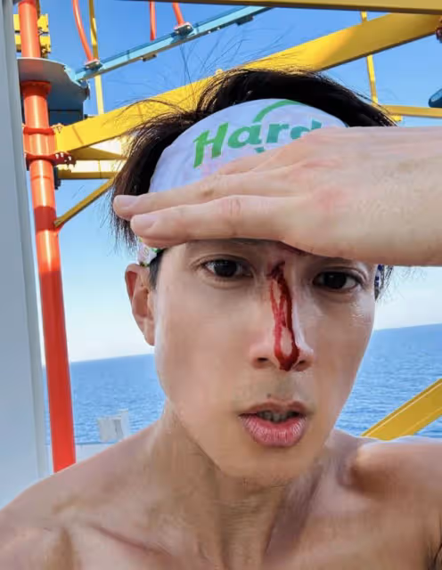 吳尊打籃球鼻樑受傷流血,先淡定拍照留念,在線求助自曝傷口很深
