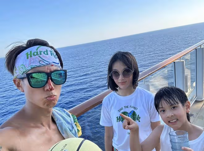 吳尊打籃球鼻樑受傷流血,先淡定拍照留念,在線求助自曝傷口很深