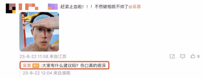 吳尊打籃球鼻樑受傷流血,先淡定拍照留念,在線求助自曝傷口很深