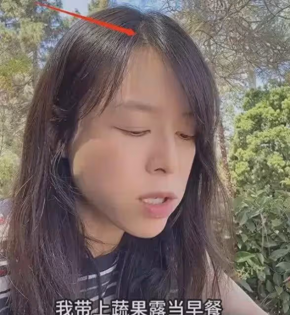 43歲張靜初現狀令人擔憂,吃生花菜臉色黃綠,堅持吃素頭髮稀疏!