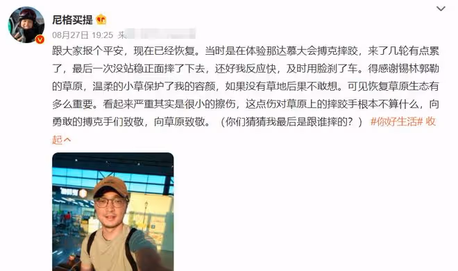 尼格買提錄節目意外受傷!臉部眼睛紅腫似有血,本人立馬報平安