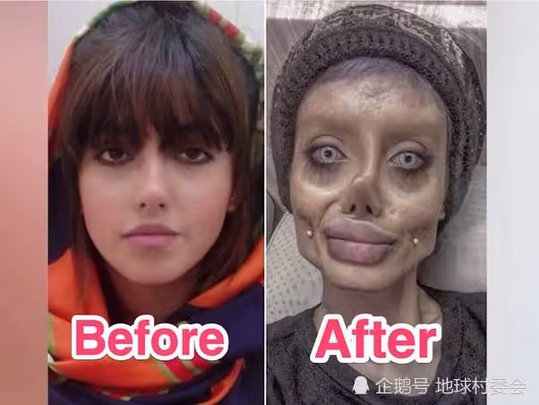 歲月不曾饒過誰,自然規律不可違背,曆數名人整容後的災難