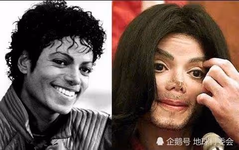 歲月不曾饒過誰,自然規律不可違背,曆數名人整容後的災難