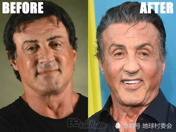 歲月不曾饒過誰,自然規律不可違背,曆數名人整容後的災難
