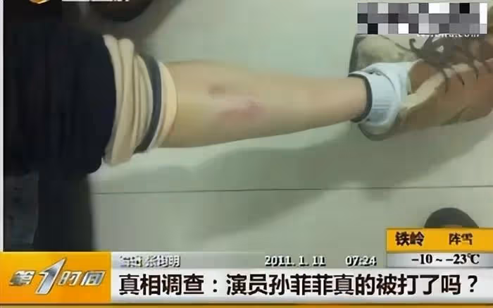 孫菲菲再揭霸凌真相,直指行業黑箱操作,導演妻子不堪壓力關評