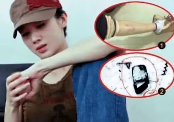 孫菲菲被打風波升級!王陽道歉,導演妻子曝關鍵證據,撕下遮羞布