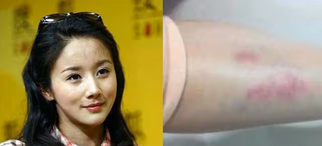 拒絕暴力!孫菲菲曝出被導演毆打真相,王陽回復引發爭議與質疑?