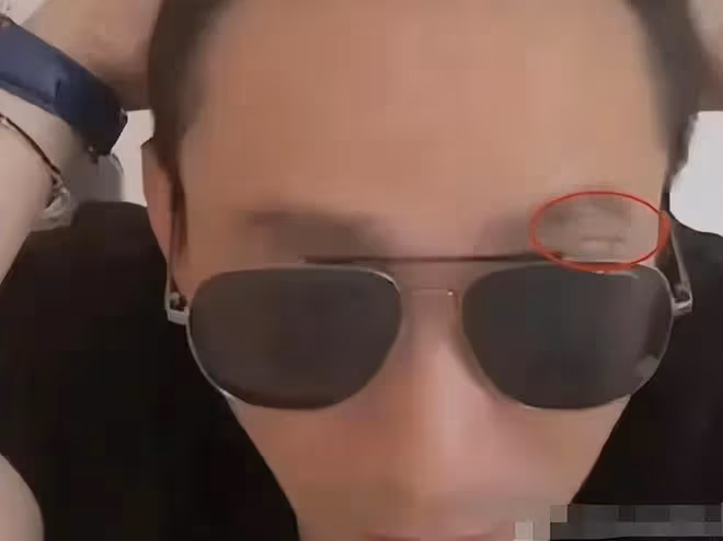 汪小菲傷未愈戴墨鏡直播,吐槽兒女總要錢,語氣失望親子關係恐變