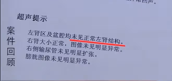 陝西女子體檢發現左腎丟失,意外牽出8年前手術疑雲,獲賠26萬