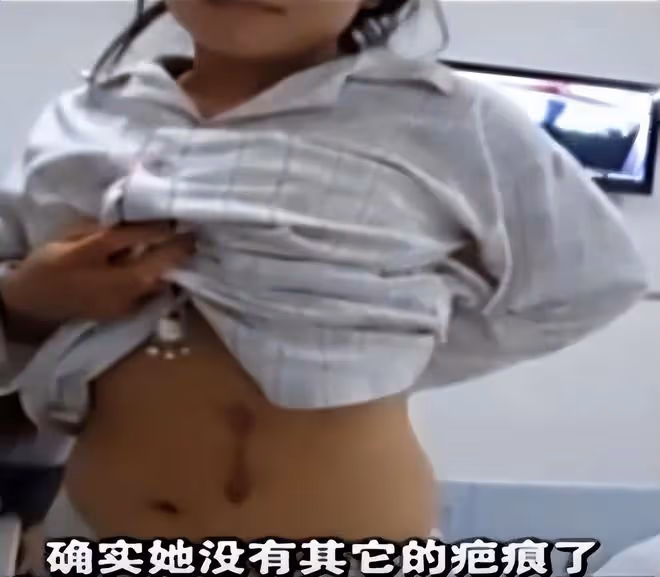 陝西女子體檢發現左腎丟失,意外牽出8年前手術疑雲,獲賠26萬