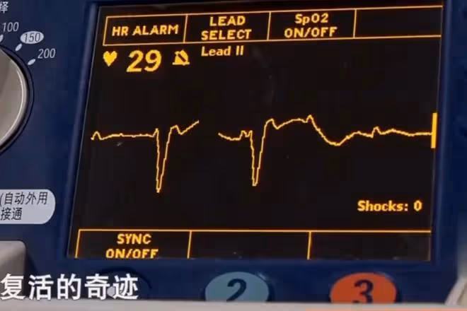 回顧老人停止心跳,搶救30分鐘無效,2歲孫子喚醒奶奶,眾人淚目