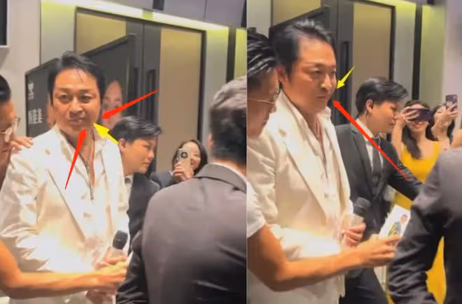 61歲馬景濤給微商站台,嘴歪臉腫還謝頂,與小30歲嬌妻3婚剛倆月