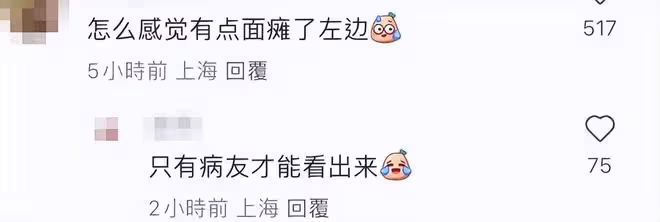 馬景濤這是怎麼了?演出期間做歪嘴動作,網友懷疑他中風面癱