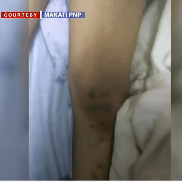 參加11名男子的派對,23歲空姐暴斃酒店,體內測出11人DNA