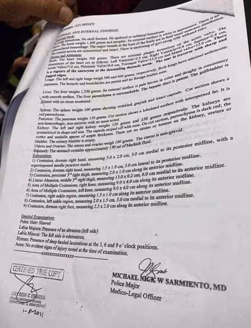 參加11名男子的派對,23歲空姐暴斃酒店,體內測出11人DNA