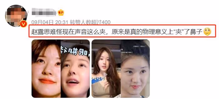 趙露思最新時尚大片,從肉鼻變小翹鼻,被網友質疑醫美了