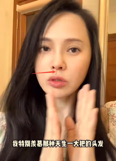 伊能靜容貌再遭質疑，人中違和嘴巴變歪，疑似出現整容後遺症