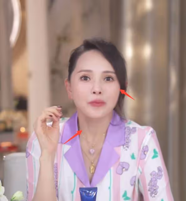 伊能靜容貌再遭質疑，人中違和嘴巴變歪，疑似出現整容後遺症