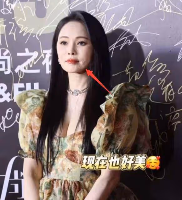 伊能靜容貌再遭質疑,人中違和嘴巴變歪,疑似出現整容後遺症