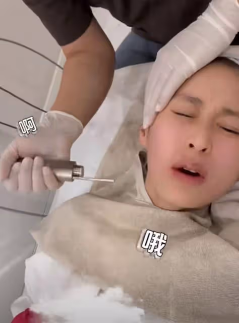 伊能靜容貌再遭質疑,人中違和嘴巴變歪,疑似出現整容後遺症