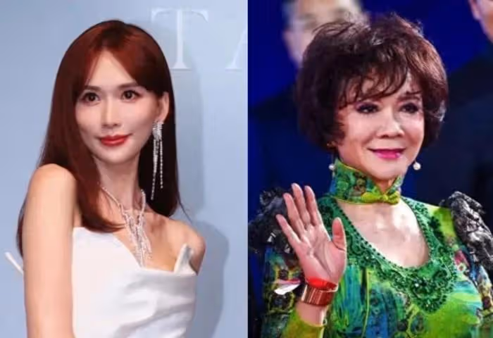 48歲林志玲模樣大變!臉僵浮腫蘋果肌凸出,皮笑肉不笑撞臉蔡明