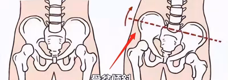 99%的人都翹「二郎腿」,對顏值的影響竟然這麼大?看完就知道了