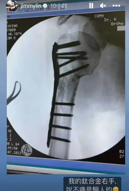48歲林志穎參加活動「面相大變樣」,給粉絲簽名吃力抬不起,粉絲表示「太心疼」