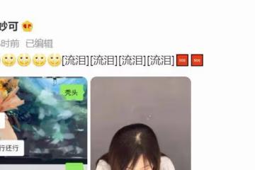 22歲童星林妙可曬禿頭照，頭頂頭髮少一大塊兒，在線發文求助網友