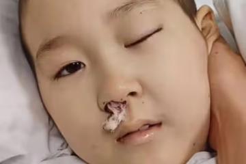 9歲抗癌網紅小旭去世，8年抗癌艱難生涯，歷經3次開顱手術6次化療