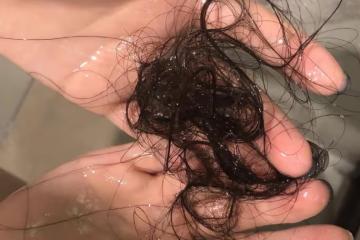 頭頂越洗越禿?做好這三步,洗完不掉發,碎發還能滿頭炸!
