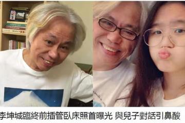 林靖恩公開李坤城臨終照片：臉部腫脹，喉嚨和鼻子在插管治療