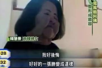 「整容上癮」韓慧景:把臉整成電風扇,自行注射食用油,代價慘痛
