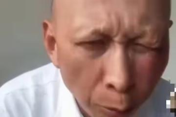 54歲老戲骨李明曬近照,臉頰紅腫明顯緊皺眉,表示要對老婆好點