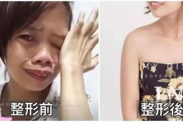 單親媽直播賺錢被笑「妳長得好像河童！」節目出錢讓她整形「變身韓系電眼女神」正到逆齡20歲