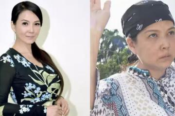 突水腫暴肥10公斤!丁國琳「全身健檢看結果嚇壞」急停工養病3個月 求助中醫揪病因「公開調理現況」