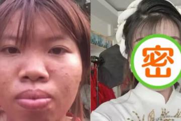 太難看被休妻!她砸錢整容「再嫁高富帥」收穫幸福婚姻,懷孕半年「卻原形畢露」被離婚, 如今「投資」回本還找到第二春