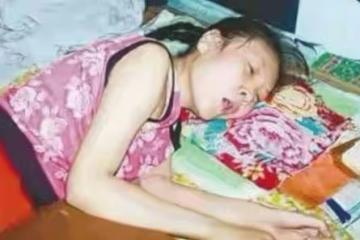 被哥哥甩2巴掌！15歲妹妹「癱瘓20年」暴瘦至30公斤　監控拍下「詭異一幕」妹妹的秘密被拆穿