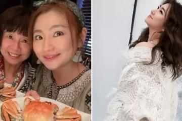 Selina罕談難忘燒傷疤痕!感謝男友治癒她,曾把傷痕比喻「美人魚的魚鱗」:愛情讓她找回了自己